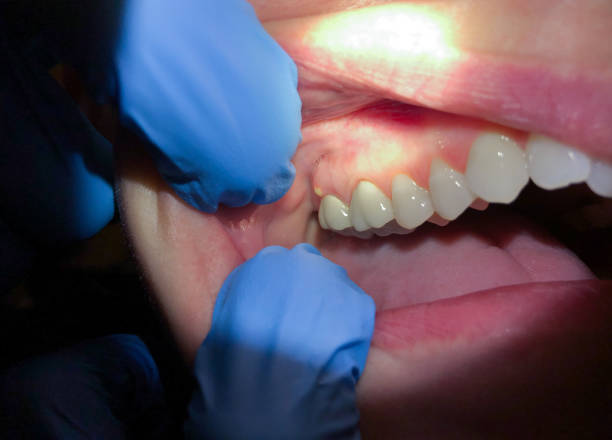 Best Weekend Emergency Dentist in On Top Of The World Designated Place, FL
